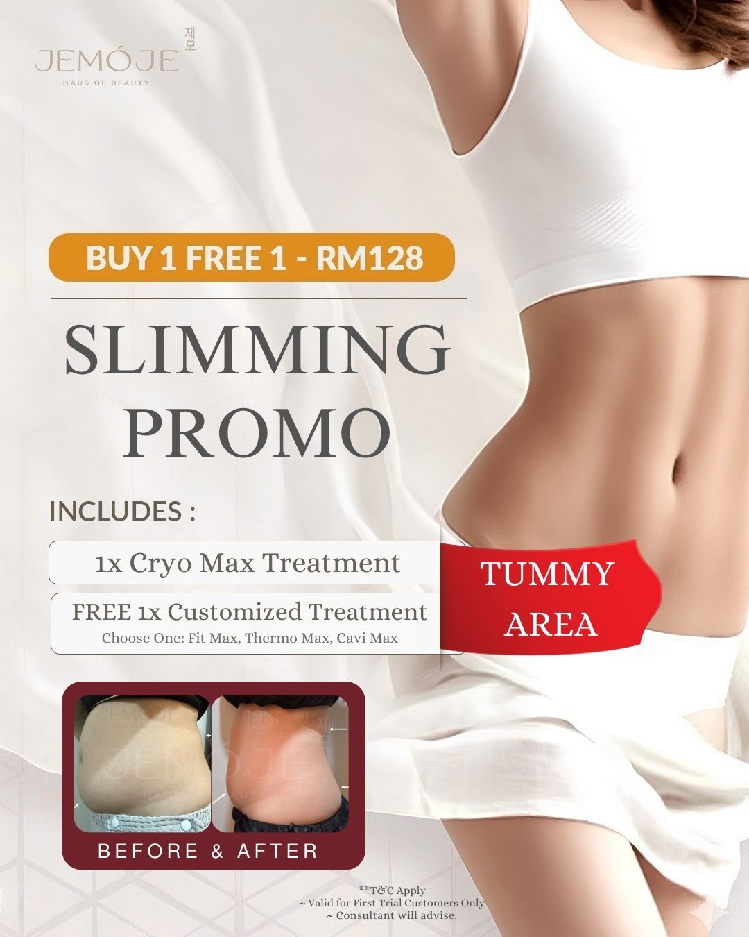 JEMOJE  - B1F1 RM 128 - Slimming First Trial Promo (Tummy Area)